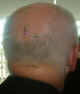 Baldingtattoo.jpg (49560 bytes)